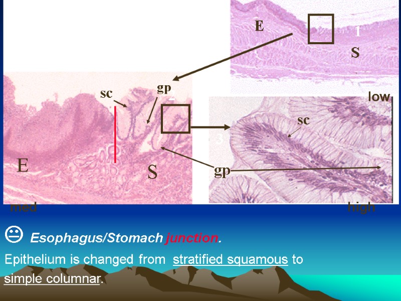  Esophagus/Stomach junction.  Epithelium is changed from  stratified squamous to  simple